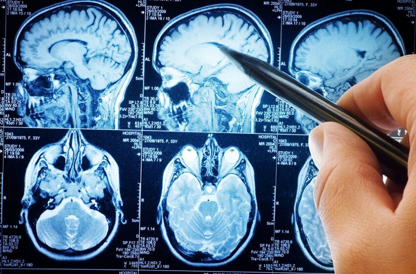 medicamento oral
